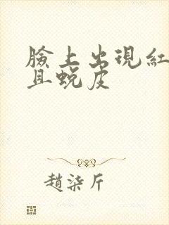 脸上出现红块并且蜕皮