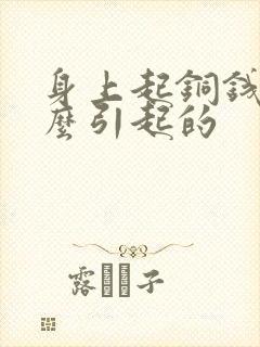 身上起铜钱癣什么引起的封面