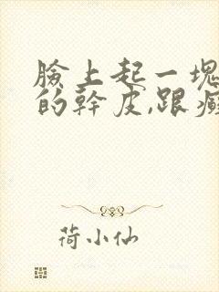 脸上起一块一块的干皮,跟癣一样是怎么回事