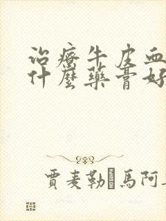 治疗牛皮血癣用什么药膏好