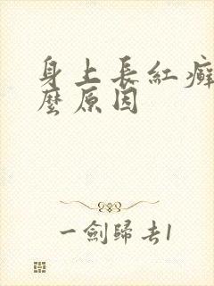 身上长红癣是什么原因