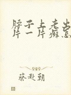 脖子上老出现一片一片癣怎么回事