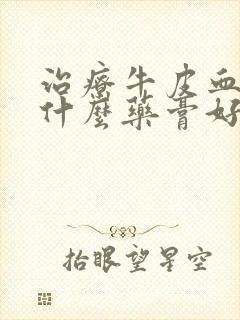 治疗牛皮血癣用什么药膏好