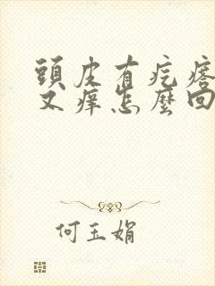 头皮有疙瘩又疼又痒怎么回事