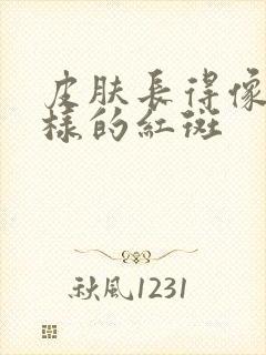 皮肤长得像癣一样的红斑封面