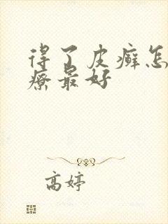 得了皮癣怎么治疗最好
