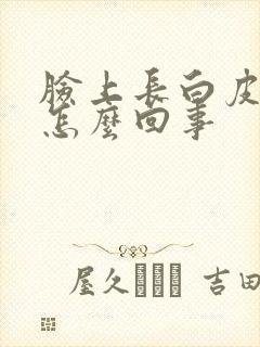 脸上长白皮癣是怎么回事
