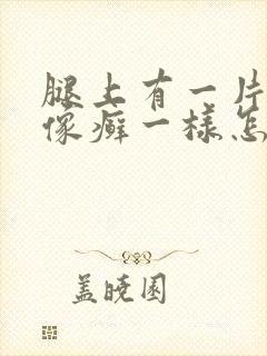 腿上有一片干燥像癣一样怎么回事封面