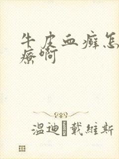 牛皮血癣怎么治疗啊