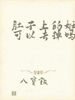 肚子上的妊辰纹可以去掉吗