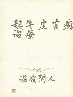 起牛皮有癣怎么治疗