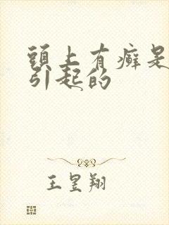 头上有癣是怎么引起的