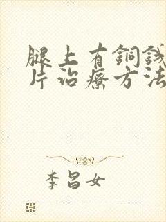 腿上有铜钱癣图片治疗方法