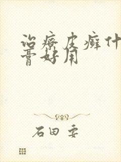 治疗皮癣什么药膏好用
