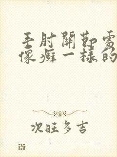 手肘关节处长了像癣一样的东西