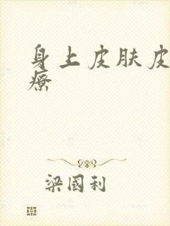 身上皮肤皮癣治疗