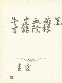牛皮血癣怎么治才能除根
