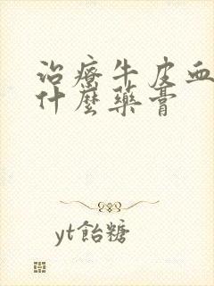 治疗牛皮血癣用什么药膏