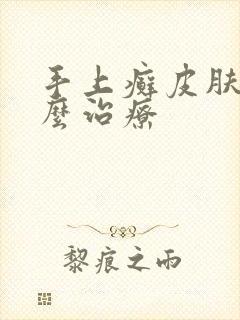 手上癣皮肤病怎么治疗封面
