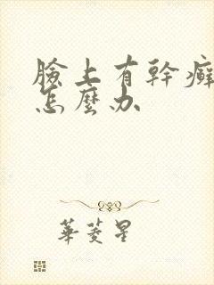脸上有干癣起皮怎么办