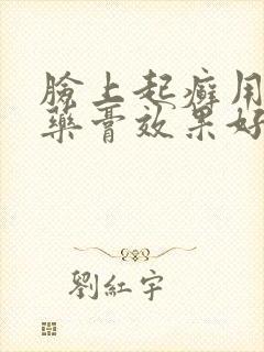 脸上起癣用什么药膏效果好