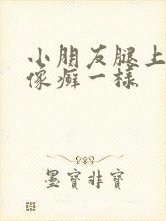小朋友腿上长了像癣一样封面