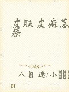 皮肤皮癣怎样治疗