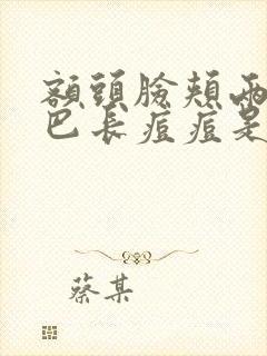 额头脸颊两侧下巴长痘痘是什么原因