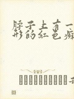 脖子上有一块圆形的红色癣