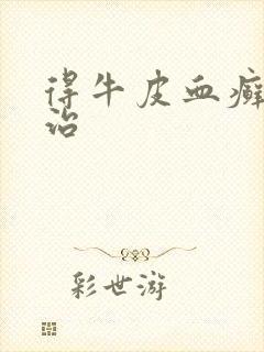 得牛皮血癣怎么治