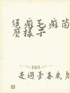 须癣毛癣菌长什么样子