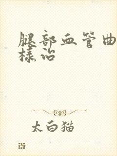 腿部血管曲张怎样治
