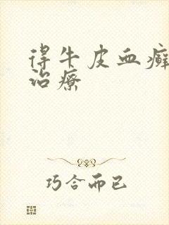 得牛皮血癣怎么治疗