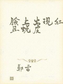 脸上出现红块并且蜕皮