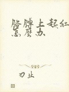 胳膊上起红色癣怎么办