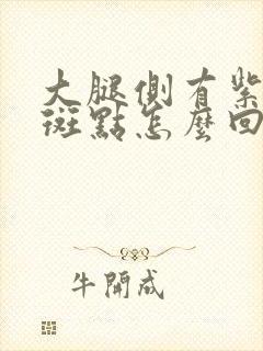 大腿侧有紫色的斑点怎么回事