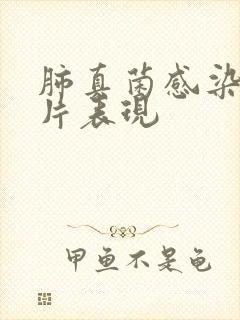 肺真菌感染ct片表现