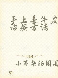 手上长牛皮有癣治疗方法