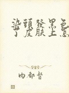 染头发黑色染到了皮肤上怎么去掉?