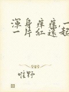 浑身痒痒,一挠一片红还起白疙瘩