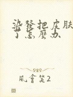 染发把皮肤染黑了怎么办