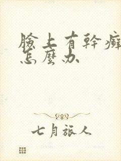 脸上有干癣起皮怎么办
