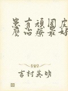 患有顽固皮癣怎么治疗最好