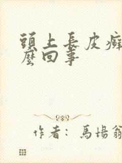 头上长皮癣是怎么回事