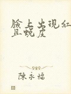 脸上出现红块并且蜕皮