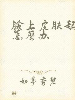 脸上皮肤起干癣怎么办