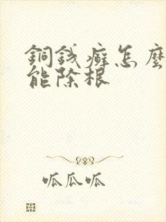 铜钱癣怎么治才能除根封面