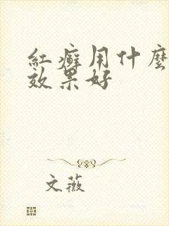 红癣用什么药膏效果好