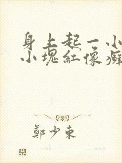 身上起一小块一小块红像癣,有点痒
