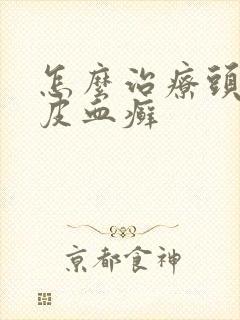 怎么治疗头上牛皮血癣
